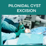 pilonidal cyst excision