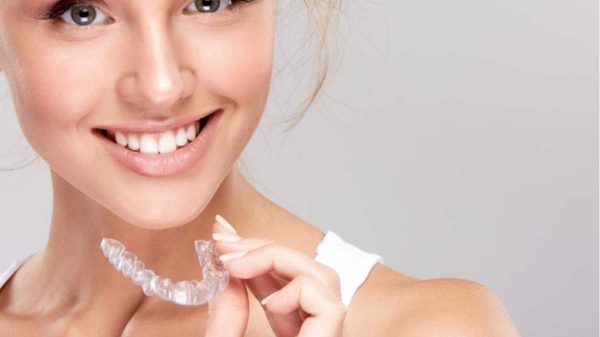 clear aligners