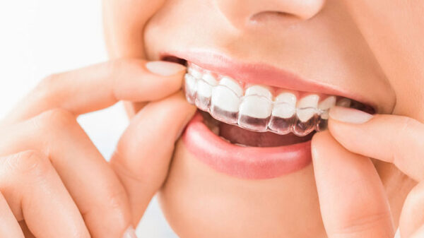 Braces vs. Invisalign in Salt Lake City: Which Option Is Right for You?